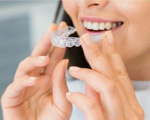 Can Invisalign Fix Overbite In Adults